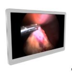 New Barco 4K UHD Color LED Surgical Display – MDSC-8255