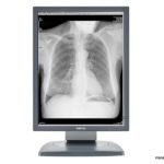 Refurnished Barco 2MP Radiology Coronis Monitors – MDCG-2121