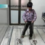 Quadriplegic Spastic Cerebral Palsy Treatment in India by Trishla Foundation