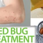 Bed Bugs Treatment Edmonton
