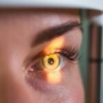 Facts you must know about Ophthalmoplegia