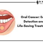 Spotting the Silent Threat: Early Diagnosis and Life-Saving Interventions for Oral Cancer