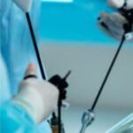 Fellowship in Endoscopy in India | Surgical Endoscopy Fellowship