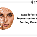 Restoring Hope: Maxillofacial Reconstruction by Leading Surgeon in Indore After Conquering Cancer