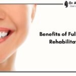 Unlock the Hidden Benefits of Full Mouth Rehabilitation: Beyond Just a Beautiful Smile