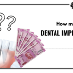 Understanding the Cost of Dental Implants in India: Key Factors and What to Expect