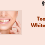 Teeth Whitening Cost – Procedure, Risks, Options & Long-Term Care Tips