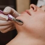 Pigmentation Treatment in Delhi: Safe and Effective Solutions for Clearer, Healthier Skin