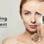 Anti Aging Treatment in Chandigarh – Advanced Solutions for Youthful and Healthy Skin