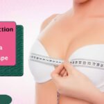 Breast Reduction Surgeon in Delhi: Expert Care for Comfort, Confidence, and Better Quality of Life