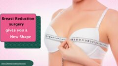 Breast Reduction Surgeon in Delhi: Expert Care for Comfort, Confidence, and Better Quality of Life
