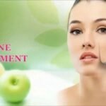 Acne Scars Treatment in Guwahati: Restore Smoother, Healthier Skin with Expert Care